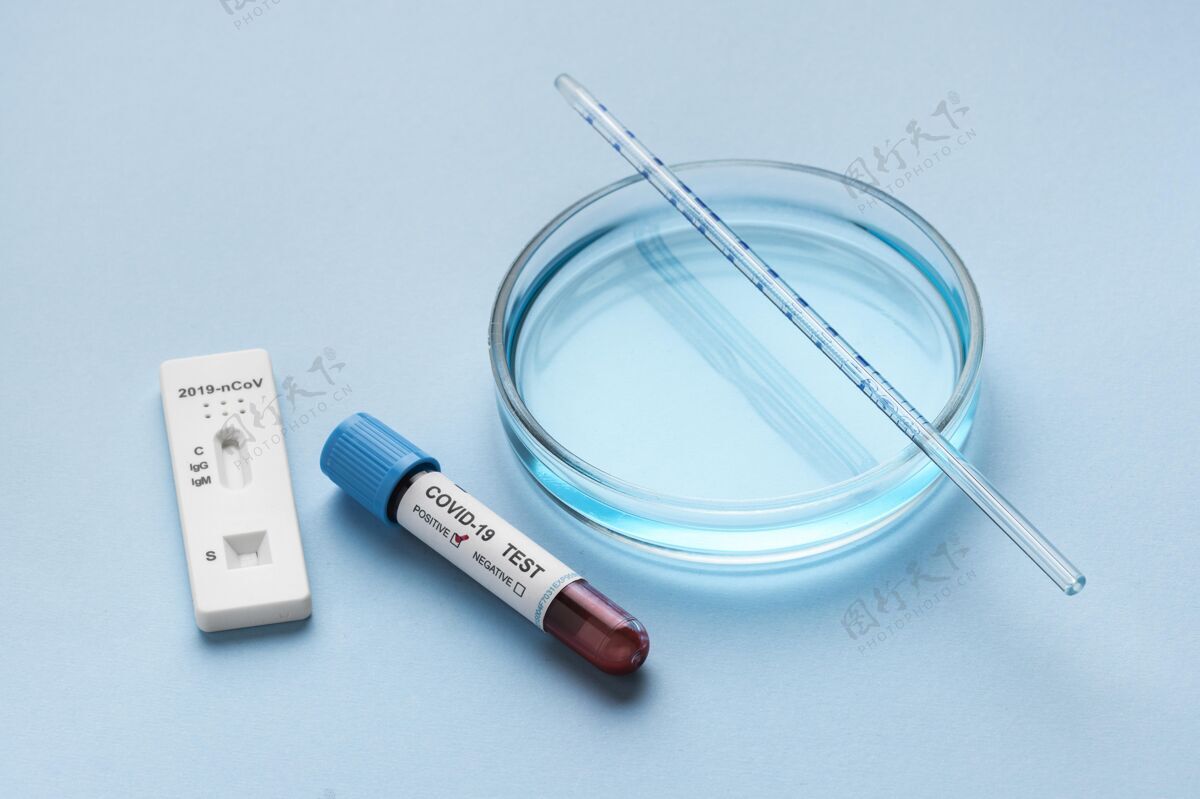 冠状病毒测试皮氏培养皿和血液样本用于covid测试感染血液测试血液样本